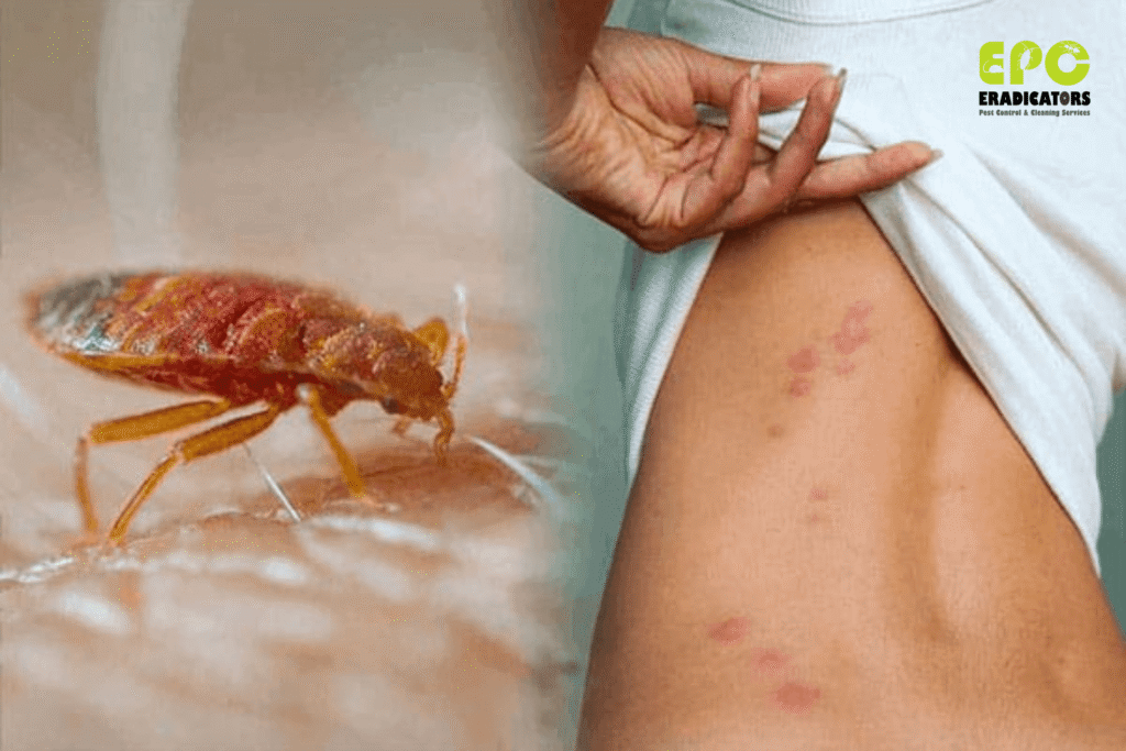 bedbugs bites what to do bedbugs allergy skin read what to do dubai